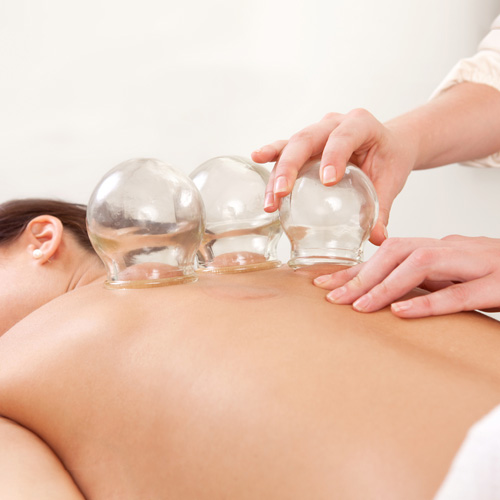 Massage Therapy Atascadero CA Cupping